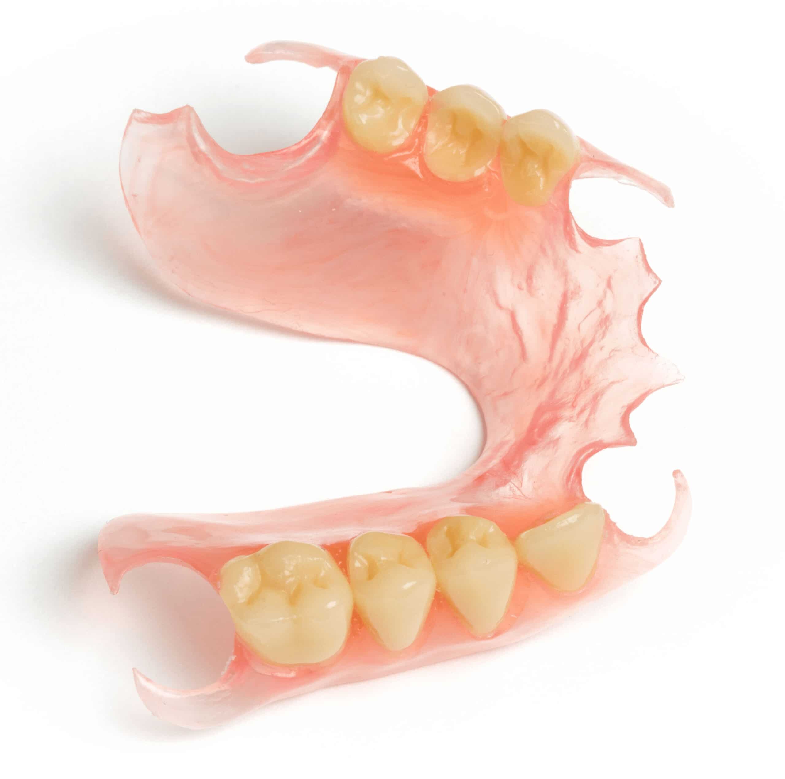 flexible valplast partial denture