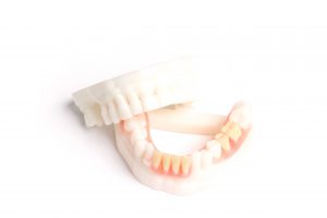 partial denture 3