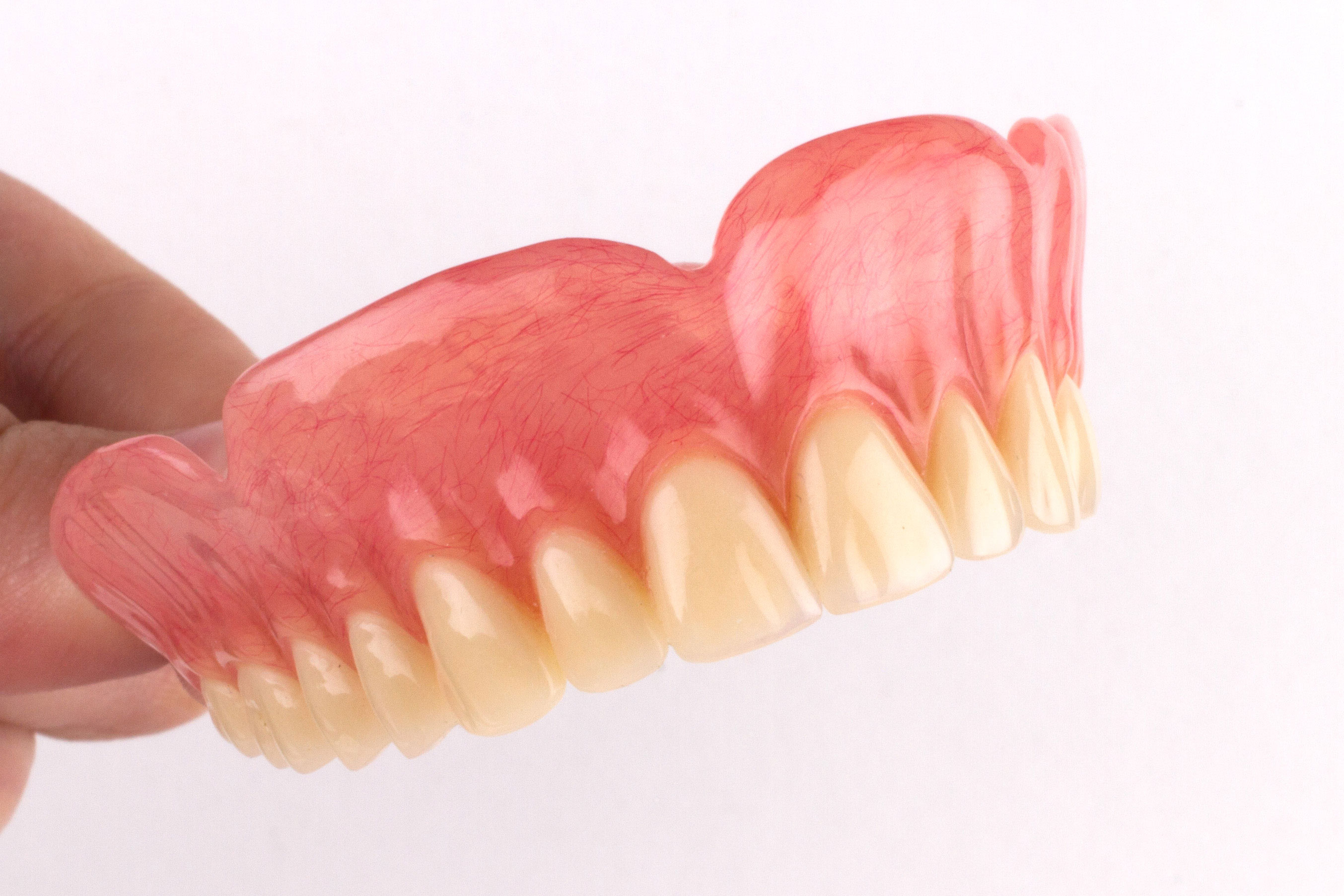 full upper denture 4