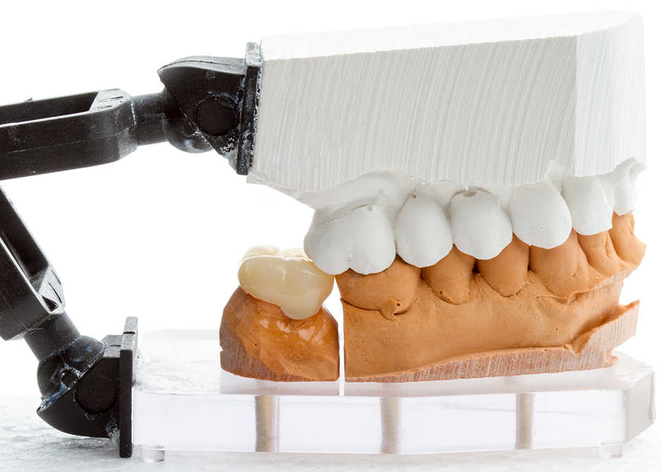 dental crown on model