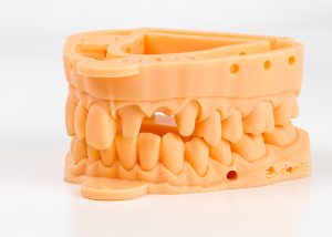3d printed dental models upper and lower